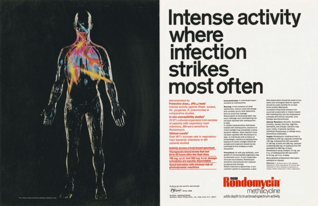 Intense activity where infection strikes most often; advertisement for Rondomycin