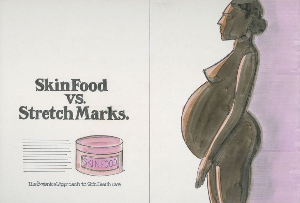 Miniature of Skin Food vs. Stretch Marks.; SkinFood Cosmetics advertisement