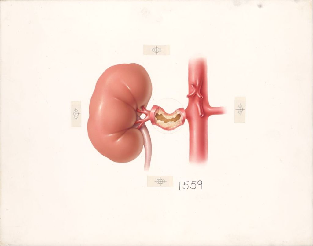 Miniature of Kidney