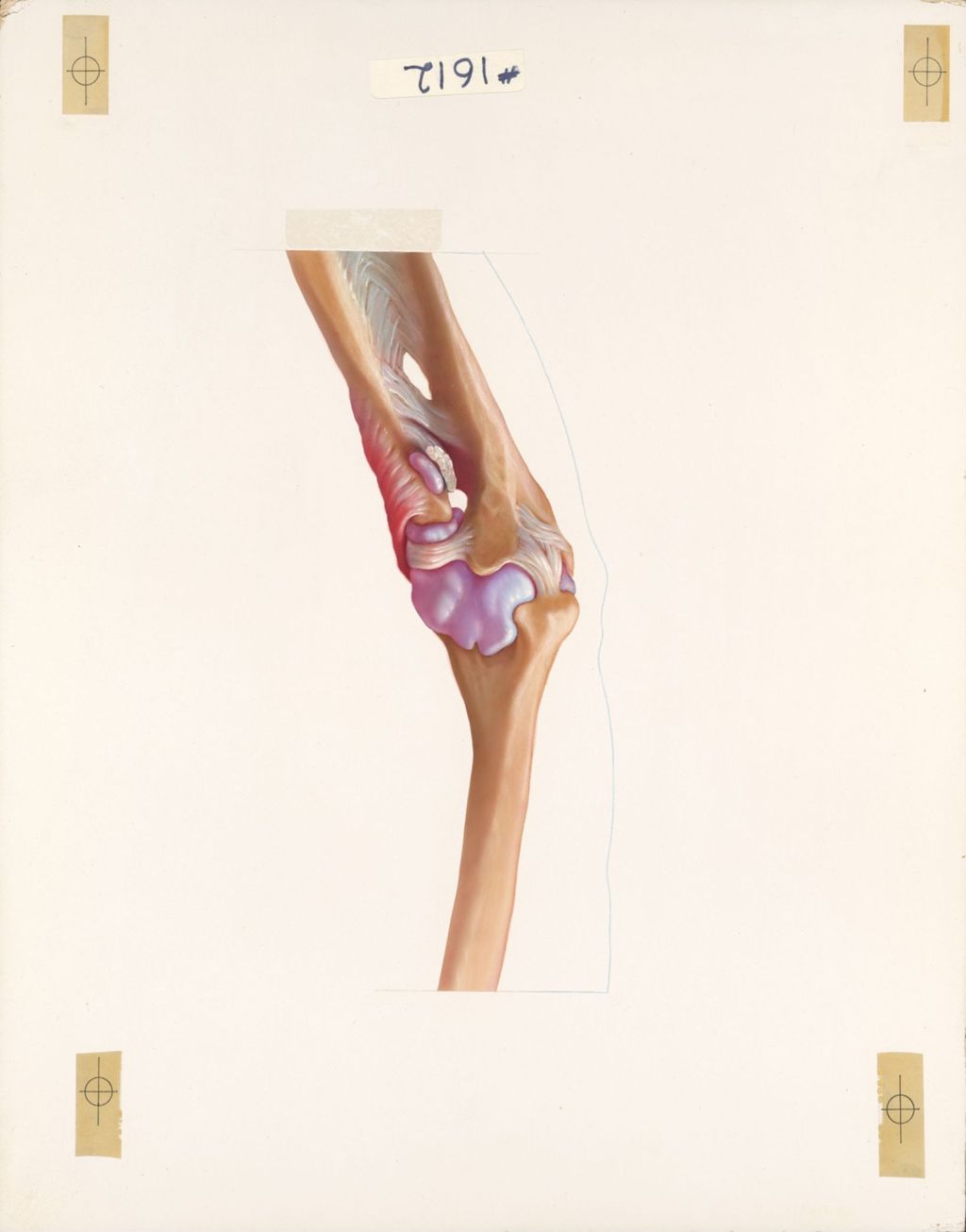 Miniature of The elbow, The synovial capsule and bursae of the elbow, anteromedial view
