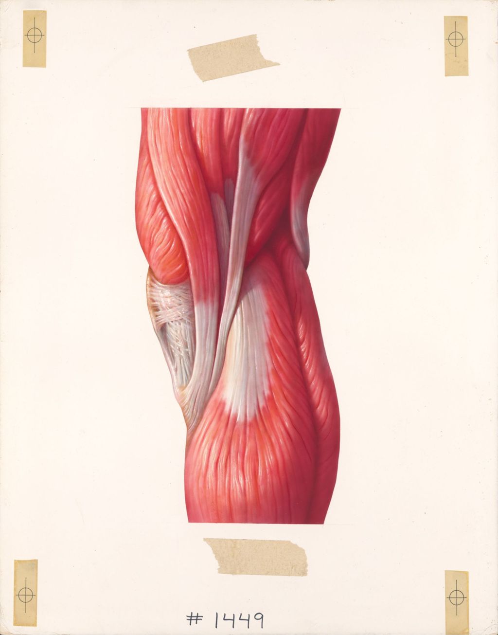Miniature of The knee, The musculature of the knee, posteromedial aspect