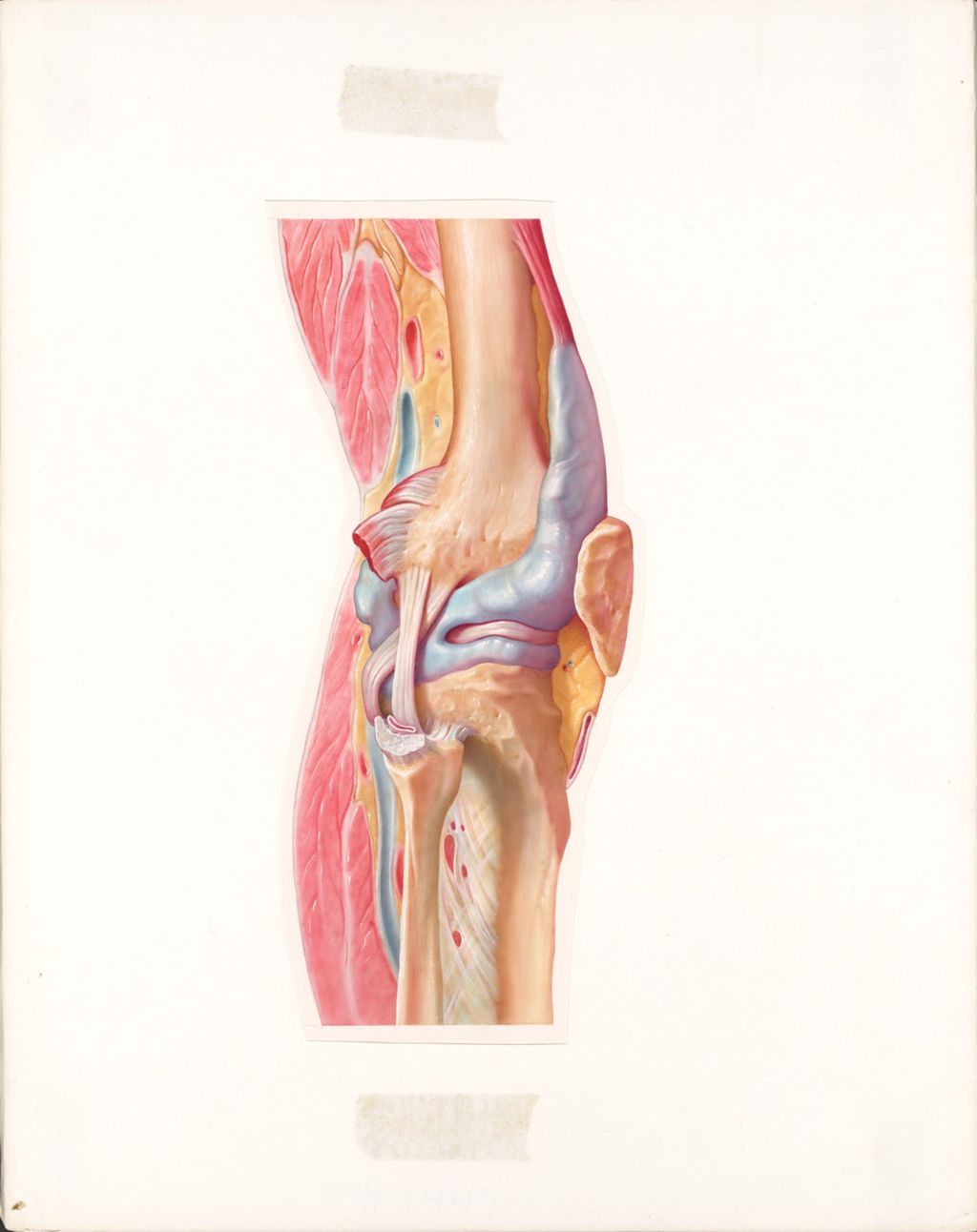 The knee, the synovial capsule and bursae of the knee, anterolateral aspect