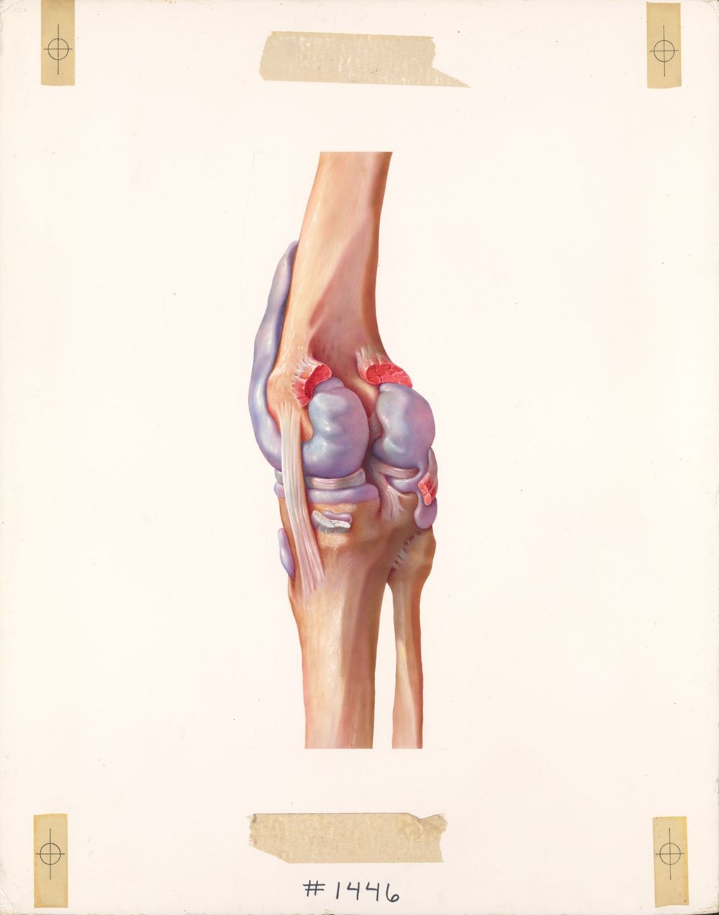 The knee, the synovial and bursae of the knee, posteromedial aspect