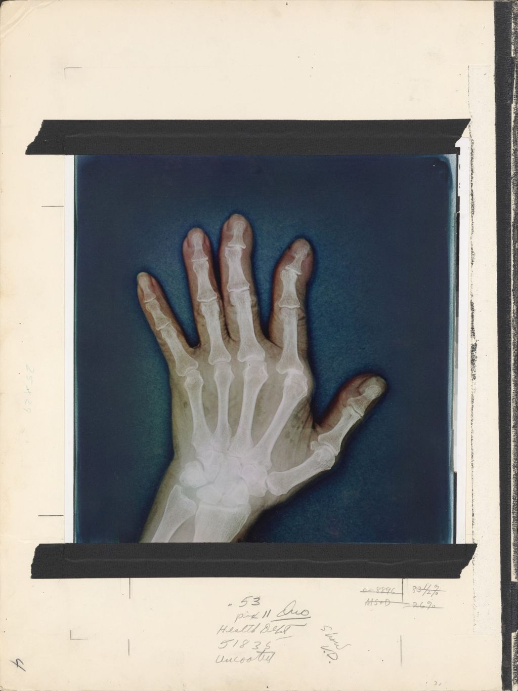 Miniature of Bones of the wrist and hand