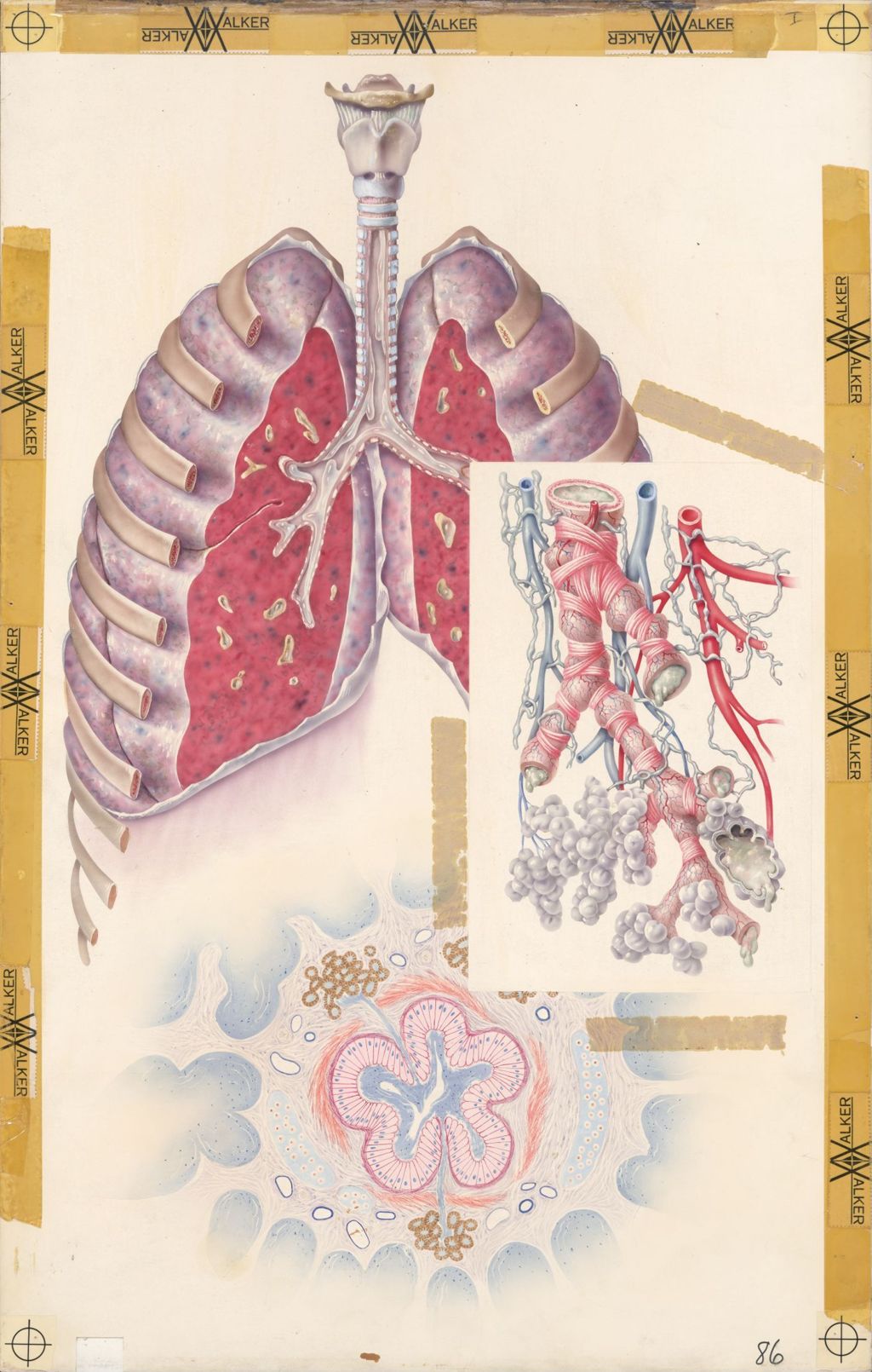 Miniature of Medical Profiles, Bronchial asthma, Decadron, Plate 2