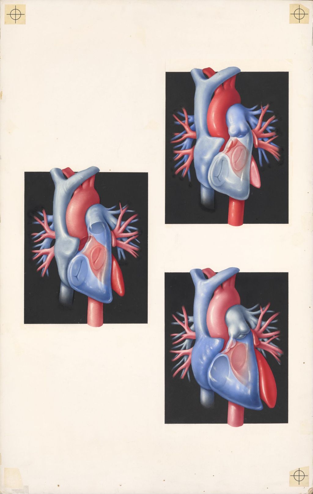 Medical profiles, cardiac auscultation, Plate 2, A visual presentation of the heart sounds