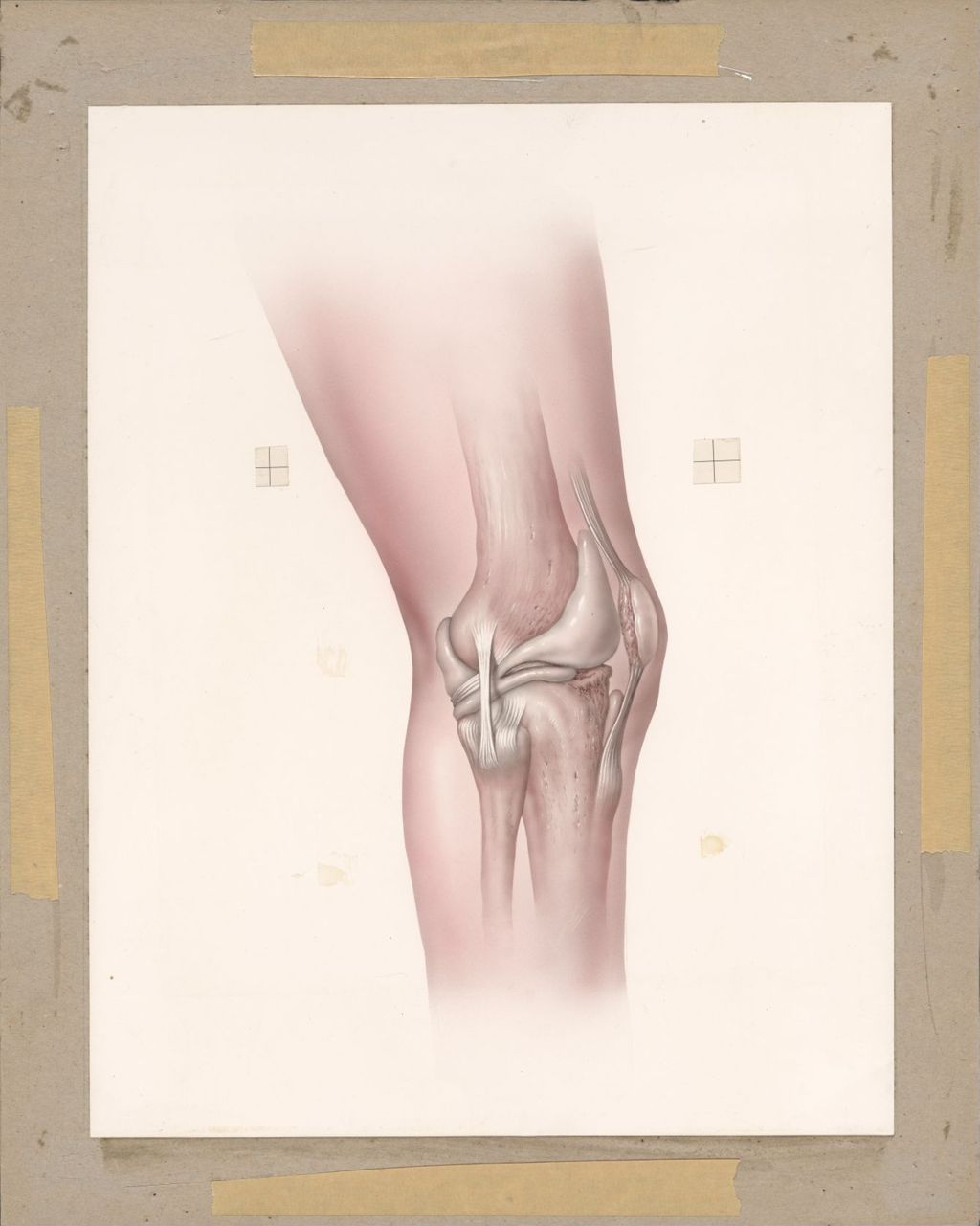 Miniature of Normal capsule knee joint