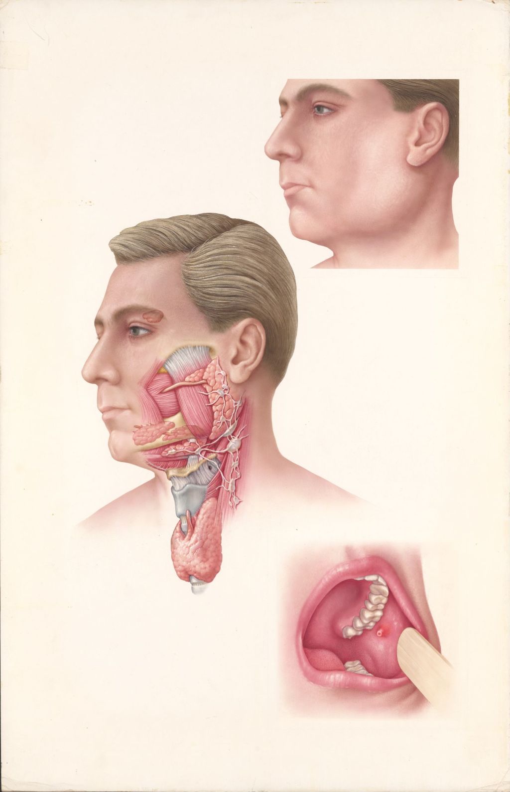 Miniature of Medical profiles, The effects of mumps on various parts of the body