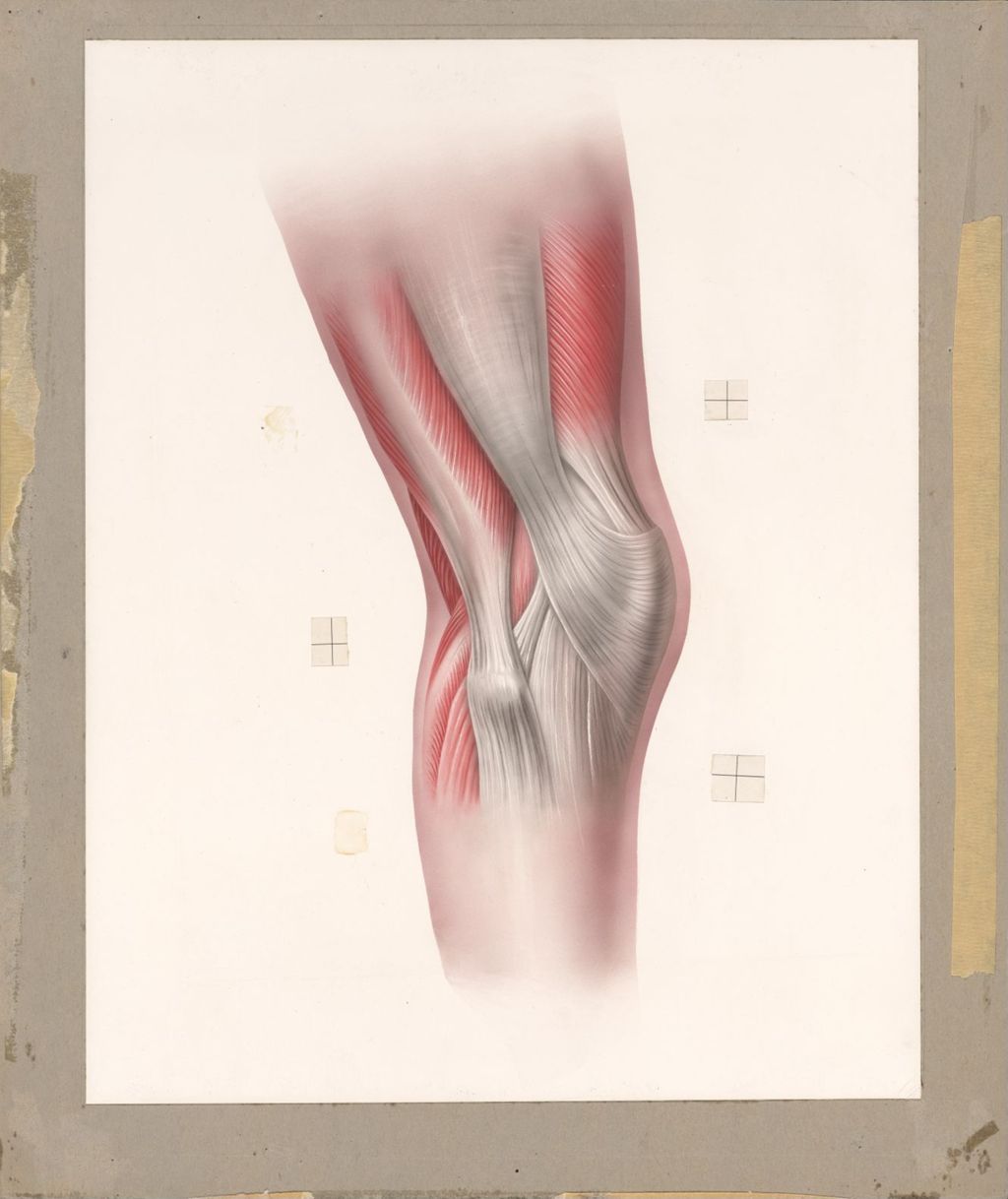 Miniature of Normal, relaxed muscles of the knee joint