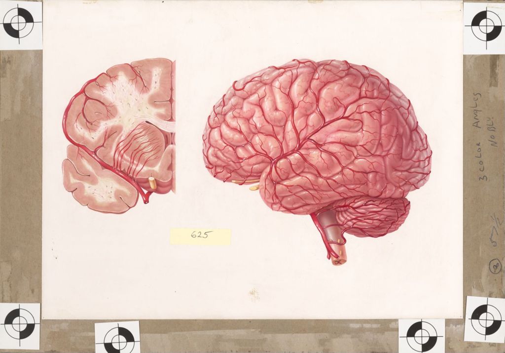 Miniature of Medical profiles, Striatran, Right half of brain seen in Art boardal section, External view of cerebrum, cerebellum, pons, and medulla