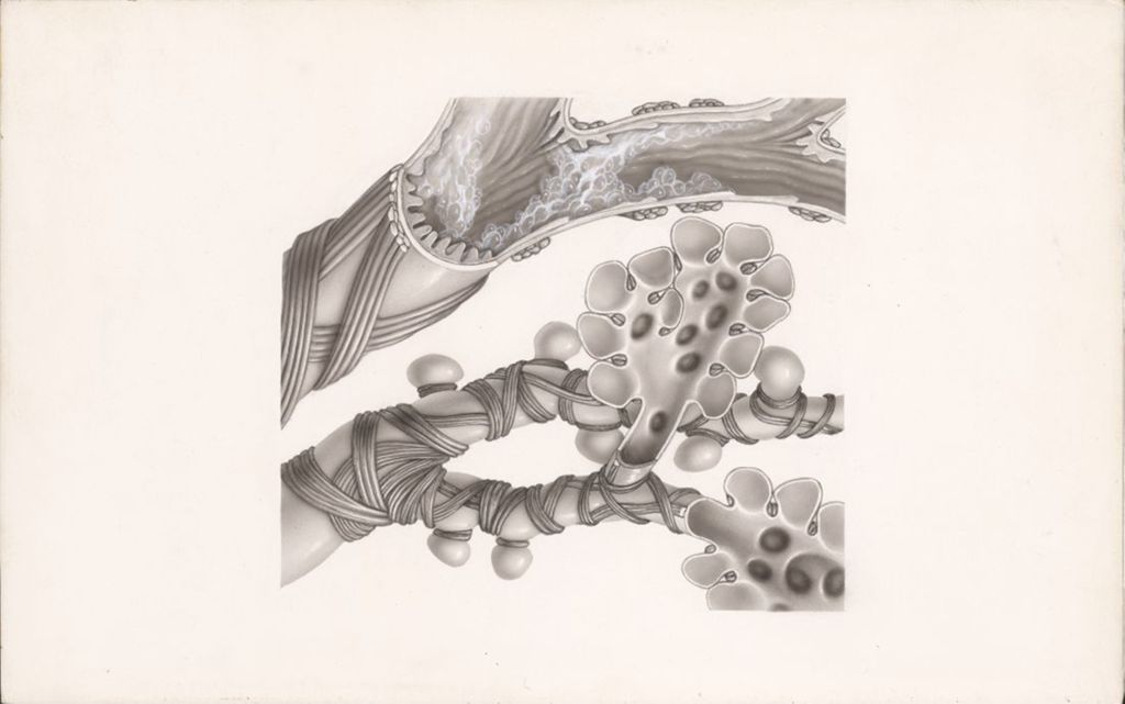 Miniature of Dornavac, Bronchopulmonary infection, Chronic bronchial asthma
