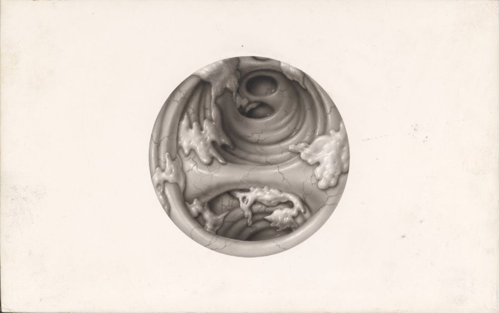 Miniature of Dornavac, Bronchopulmonary infection, Bronchoscopic view of purulent bronchitis