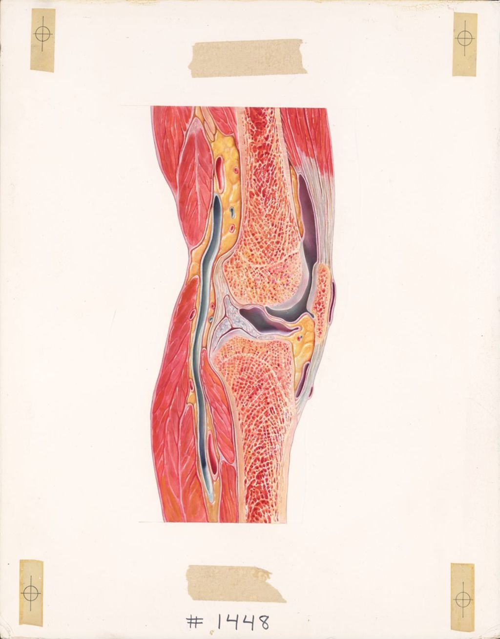 Miniature of The knee, sagittal section through the knee