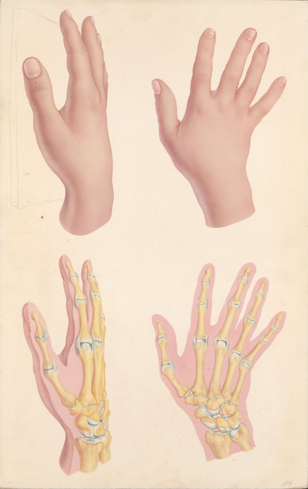 Miniature of Views of a hand
