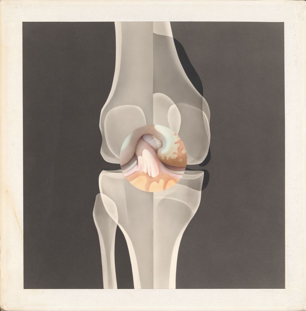 Miniature of Knee joint