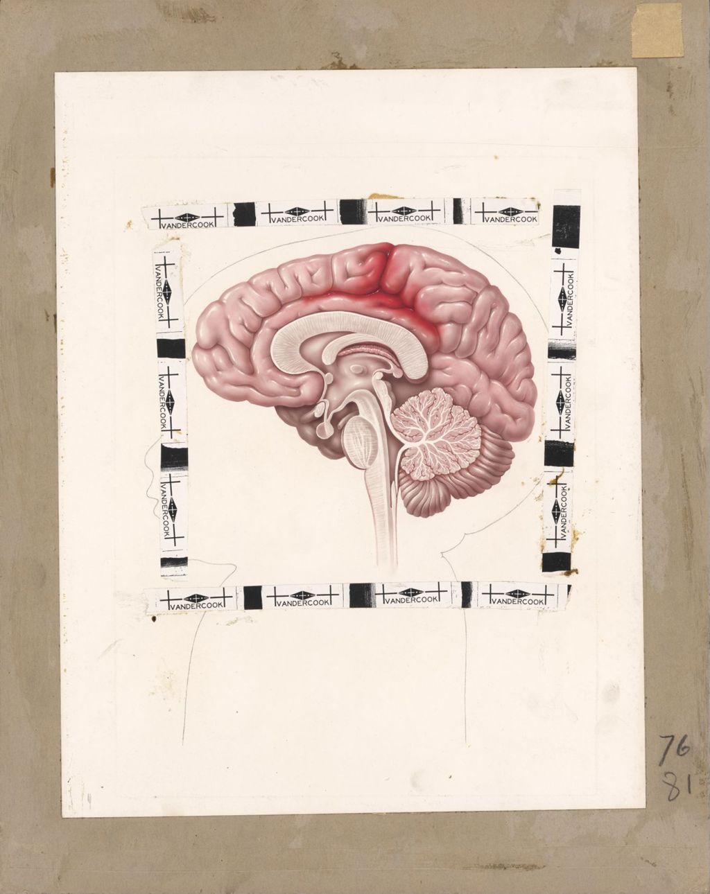 Miniature of Mephyton, Cross-section of brain