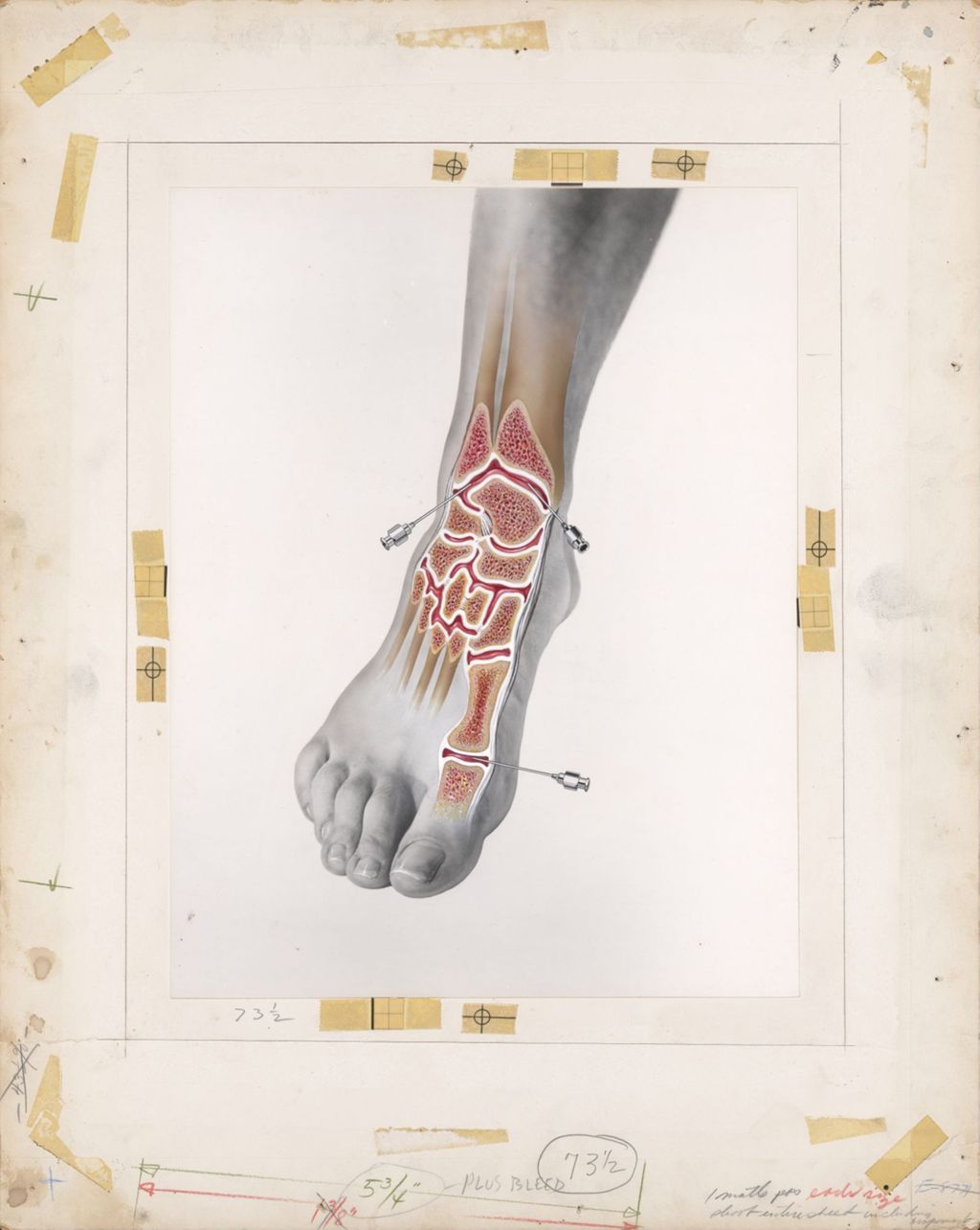 Miniature of The ankle and joints of the foot