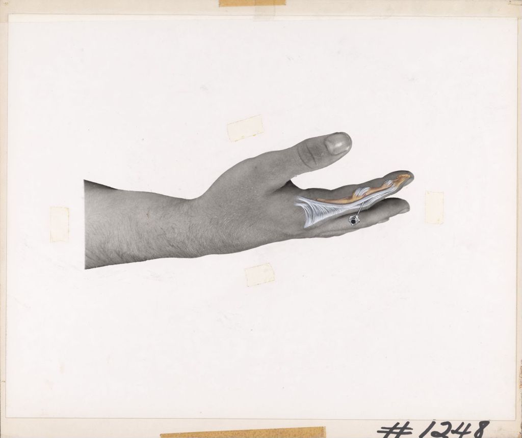 Miniature of The interphalangeal joints