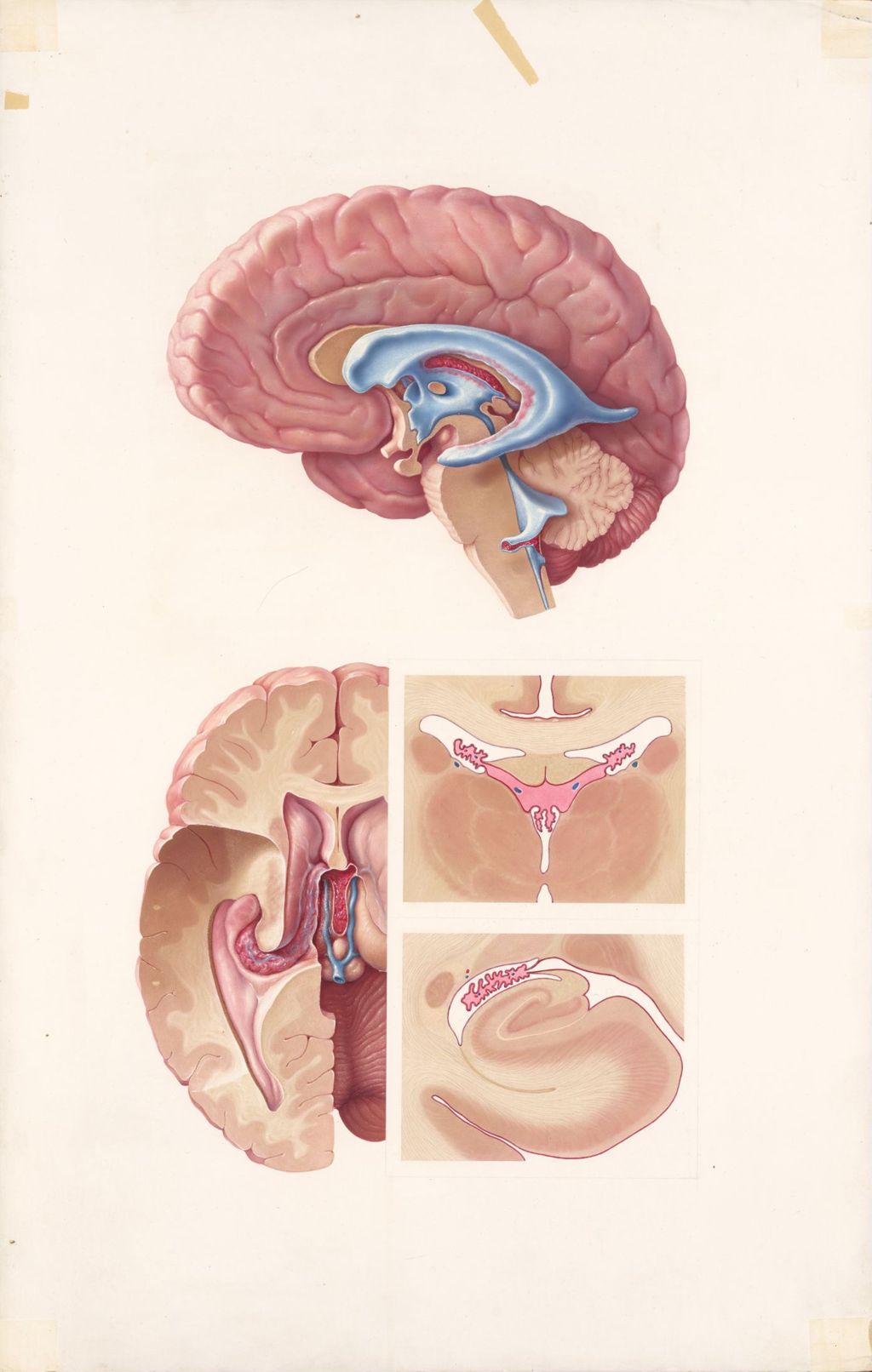 Miniature of Medical profiles, Plate 2, The choroid plexus and ventricular system