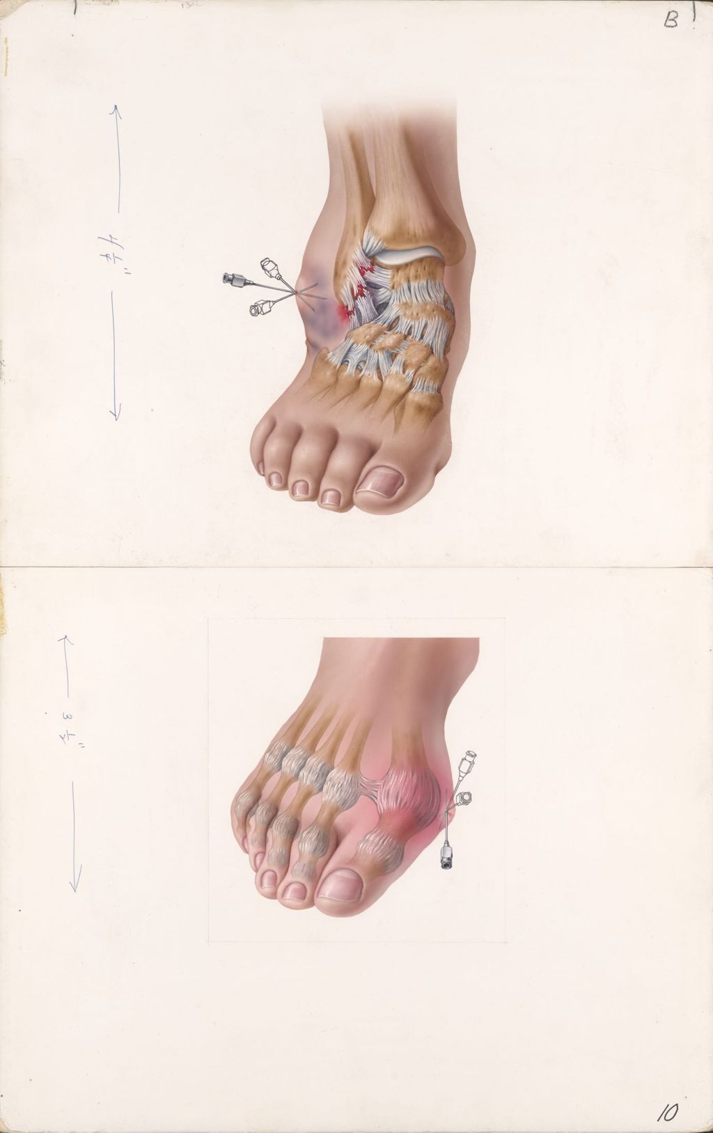 Miniature of Medical Profiles, Hydeltra TBA, Plate 1, Sprained ankle, Bunion