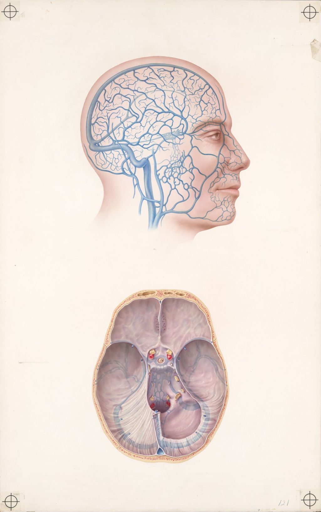 Miniature of Venous drainage of the head