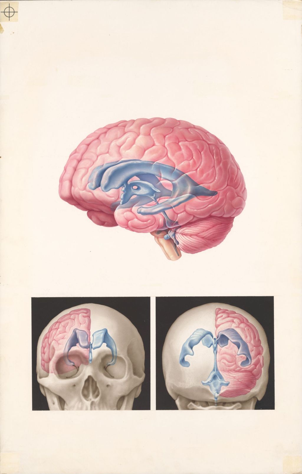 Medical Profiles, Plate I, The normal anatomy of the ventricular system of the brain
