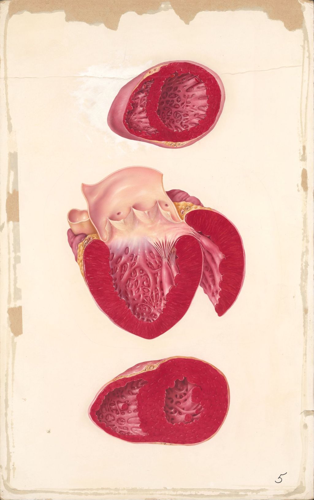 Miniature of Peck Heart 5