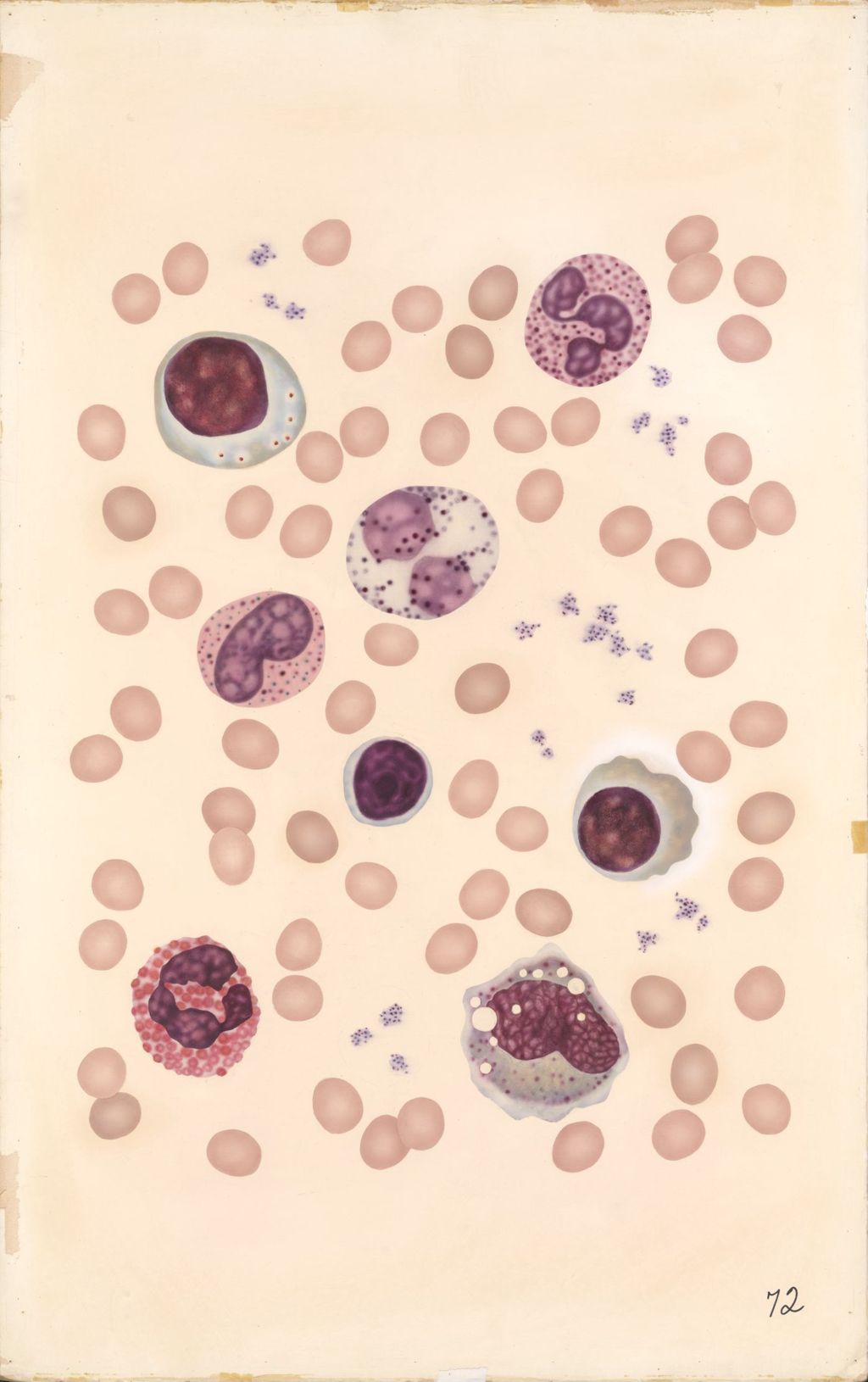 Miniature of Medical Profiles, Blood Dyscrasias Part A, Normal Blood
