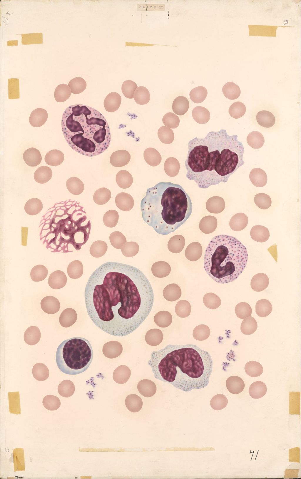 Miniature of Medical Profiles Blood Dyscrasias Part A - Normal Blood