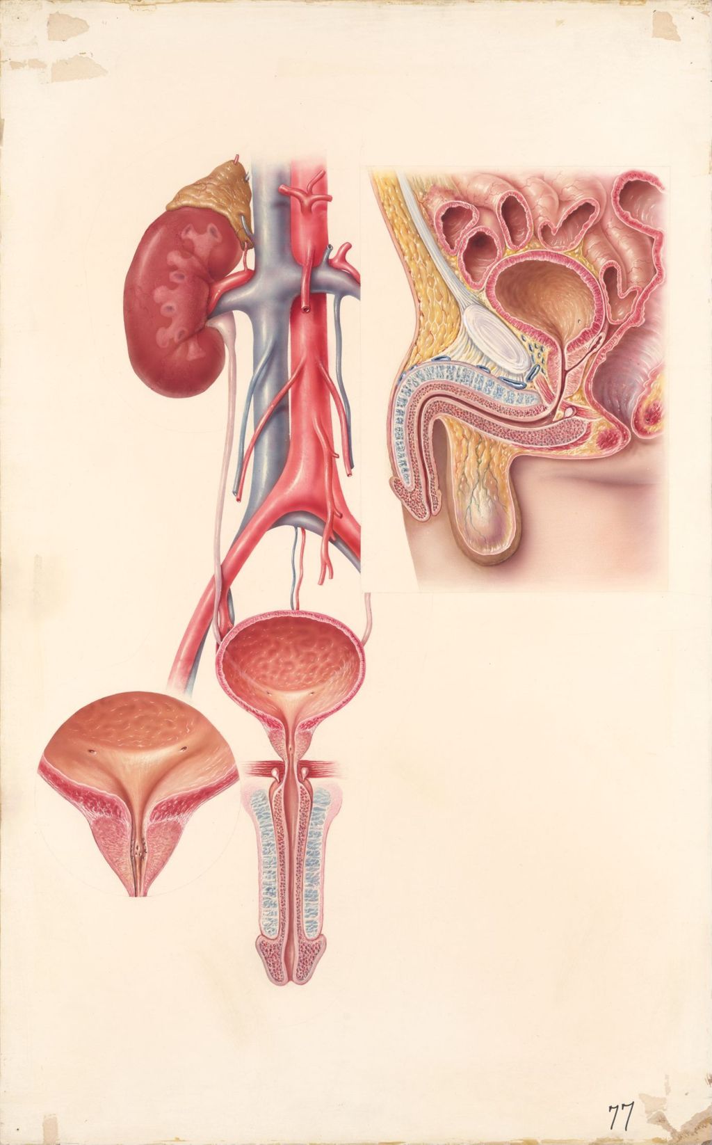 Miniature of Medical Profiles, Urocholine, Male Urinary Tract, Part A