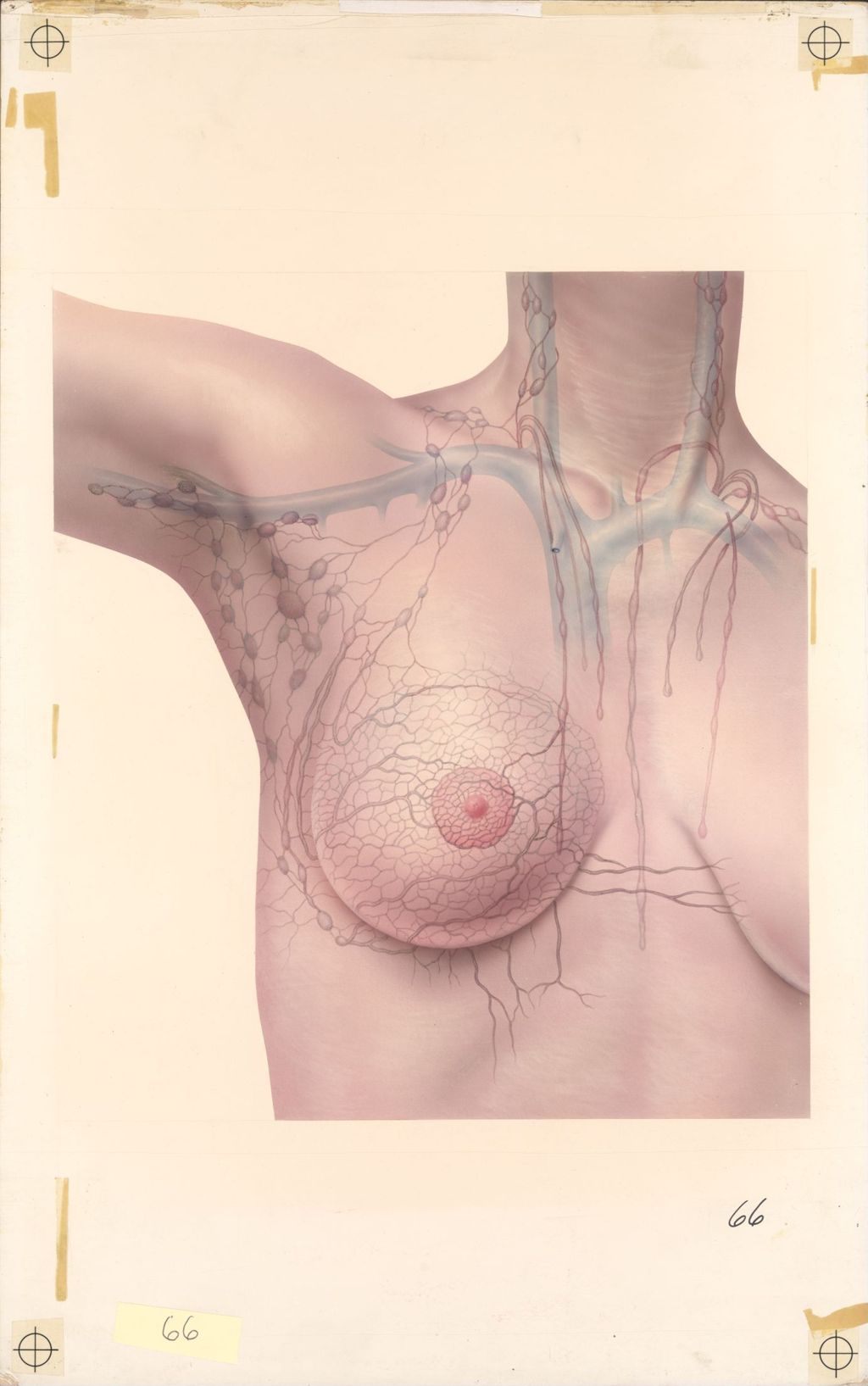 Miniature of Medical Profiles, Lymphatic Drainage of the Breast