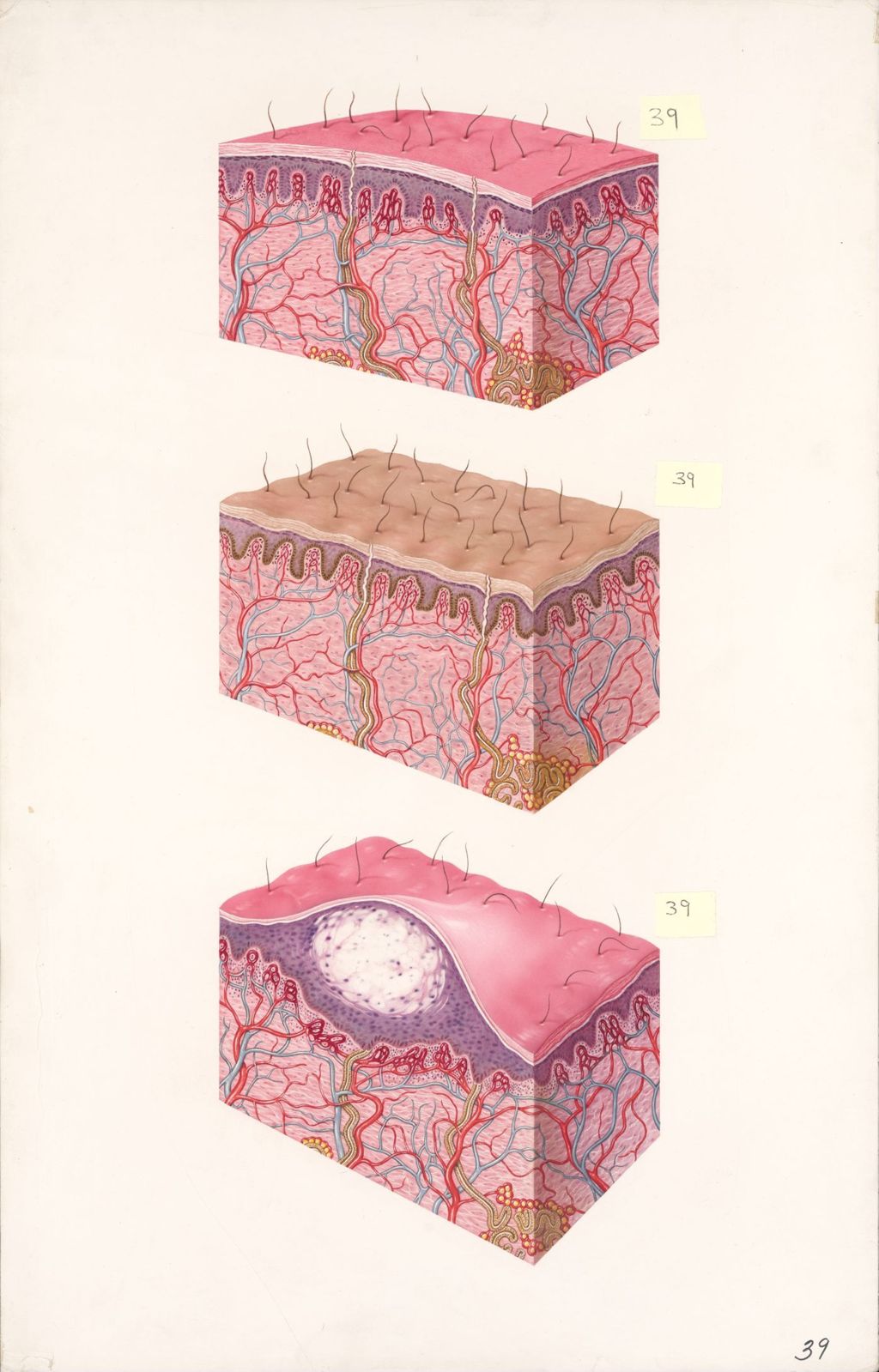 Miniature of Medical Profiles, Skin changes due to the action of the ultraviolet light and to sensitivity to the sun's rays