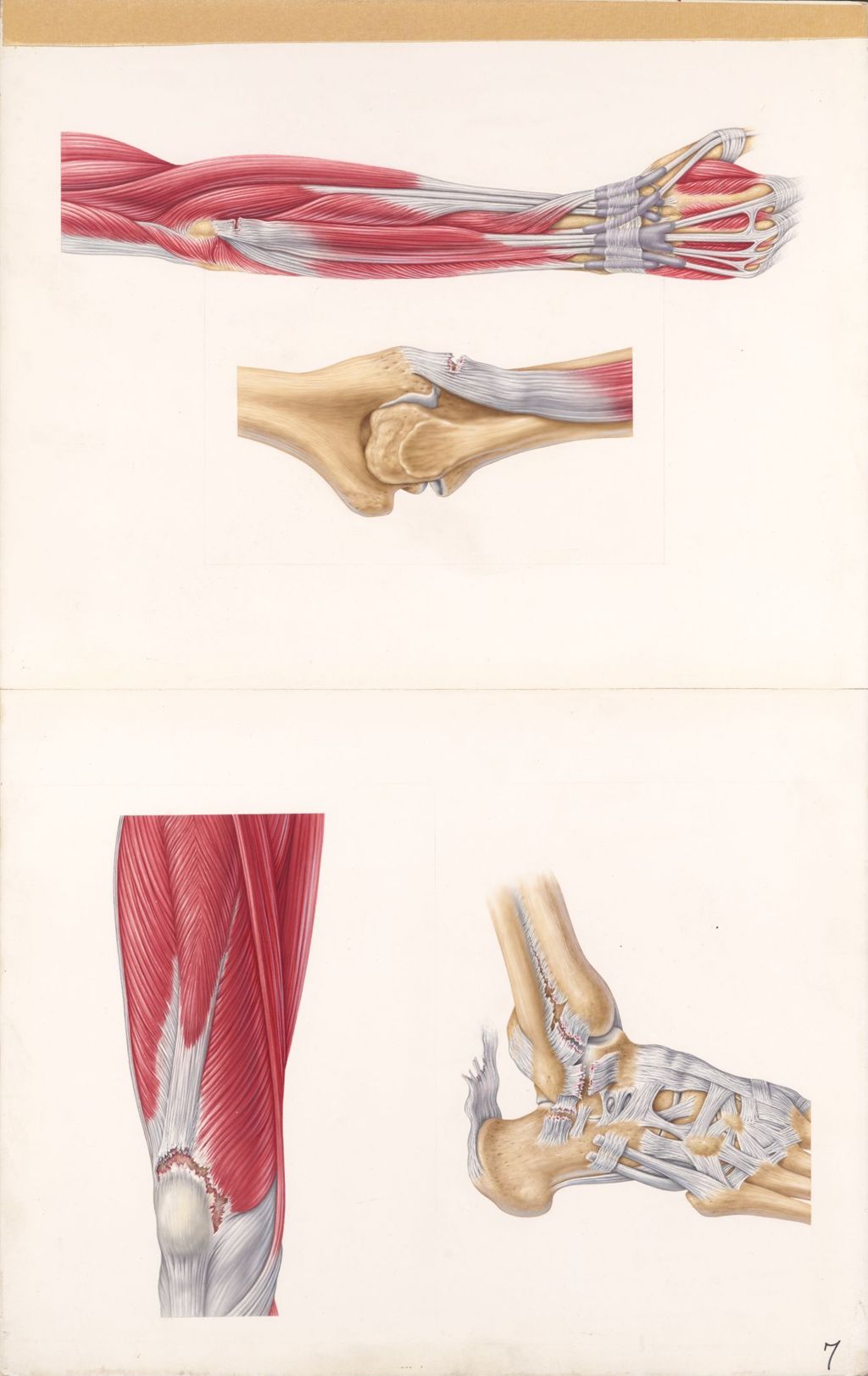 Miniature of Medical Profiles, Decadron Phosphate with Xylocaine, Sites and appearances of some musculoskeletal disorders, Plate II