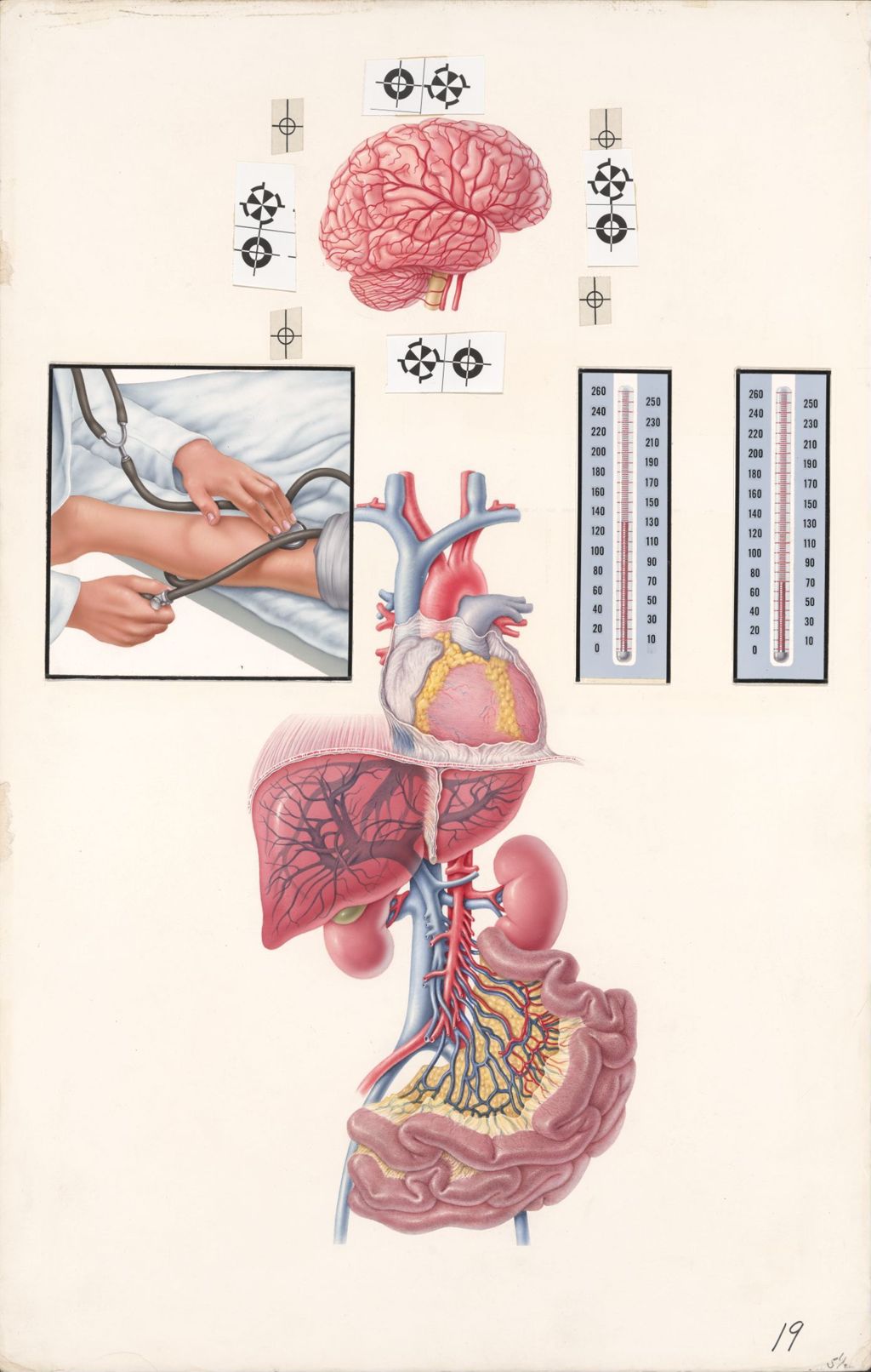 Miniature of Medical Profiles, Aldomet, Blood Flow to Vital Organs in Hypotension, Plate I