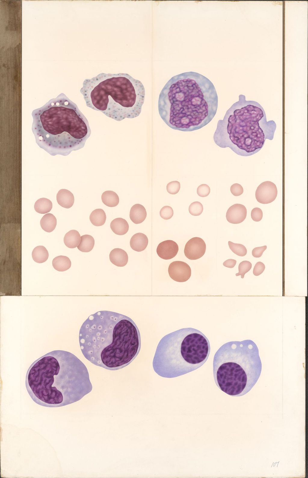 Miniature of Medical Profiles, Normal and Abnormal Blood Cells Seen In Peripheral Blood, Plate II