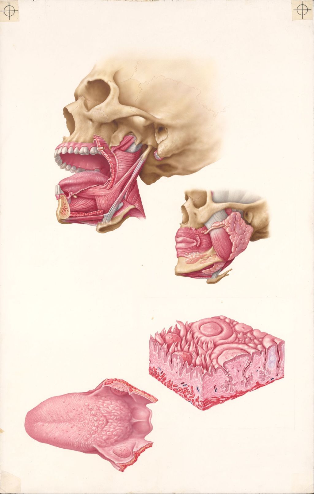 Miniature of Doctor-Patient Explanatory Atlas of Anatomy, the Normal Anatomy of the Mouth, Plate II The Tongue and Salivary Glands Exposure of the Tongue Muscles