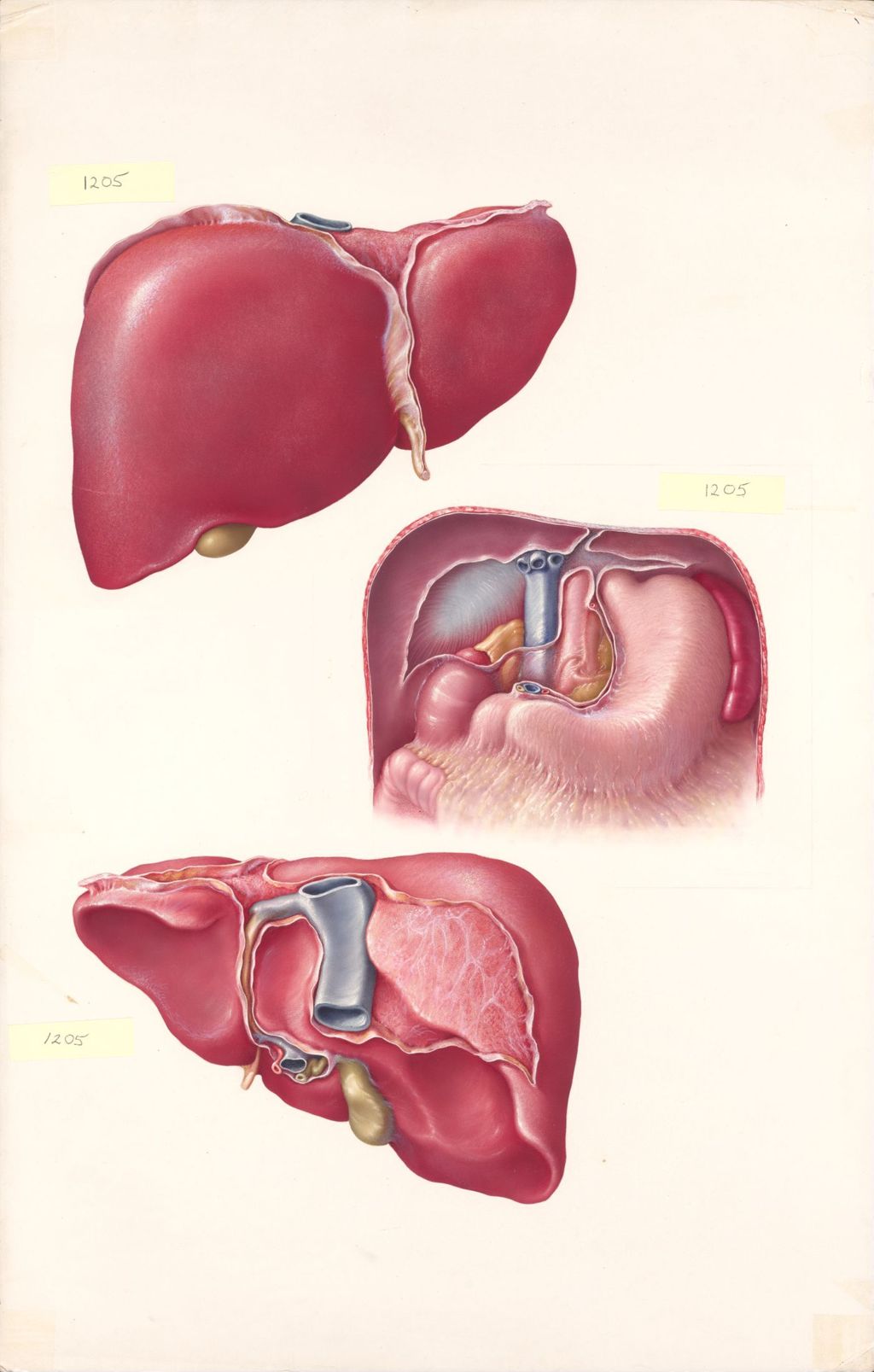 Medical Profiles, The Anatomy of the Liver, Plate I, The Liver and Its Visceral Relationships