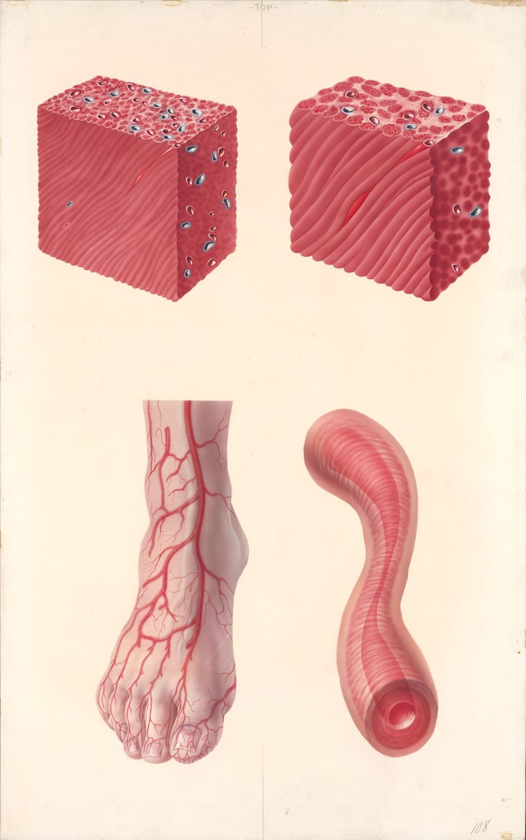 Miniature of Medical Profiles, Diupres and Hydropres, Hypertensive Heart Disease, Plate II