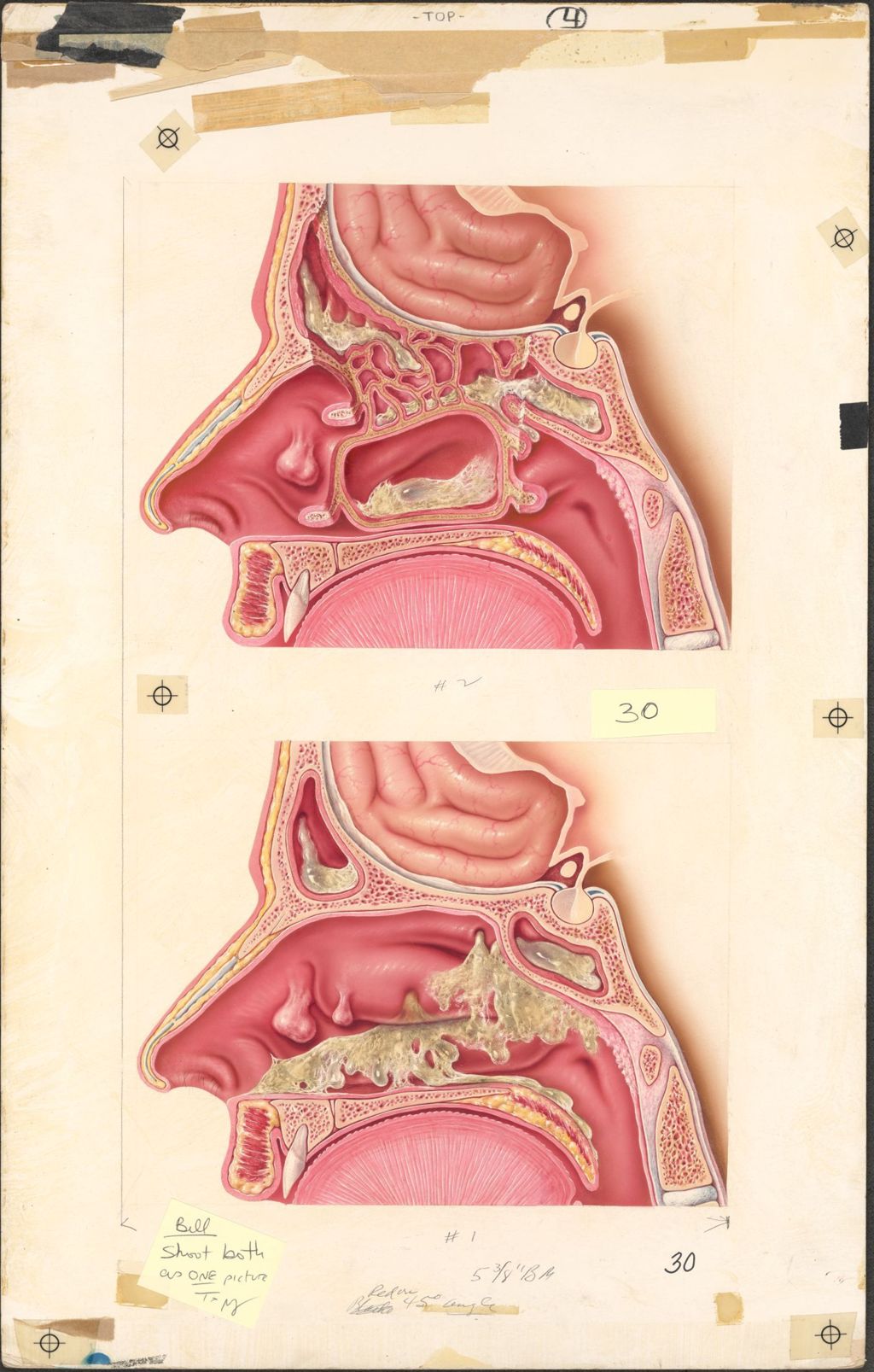 Miniature of Medical Profiles, NeoHydeltrasol Nasal Spray, Anatomy of Paranasal Sinuses