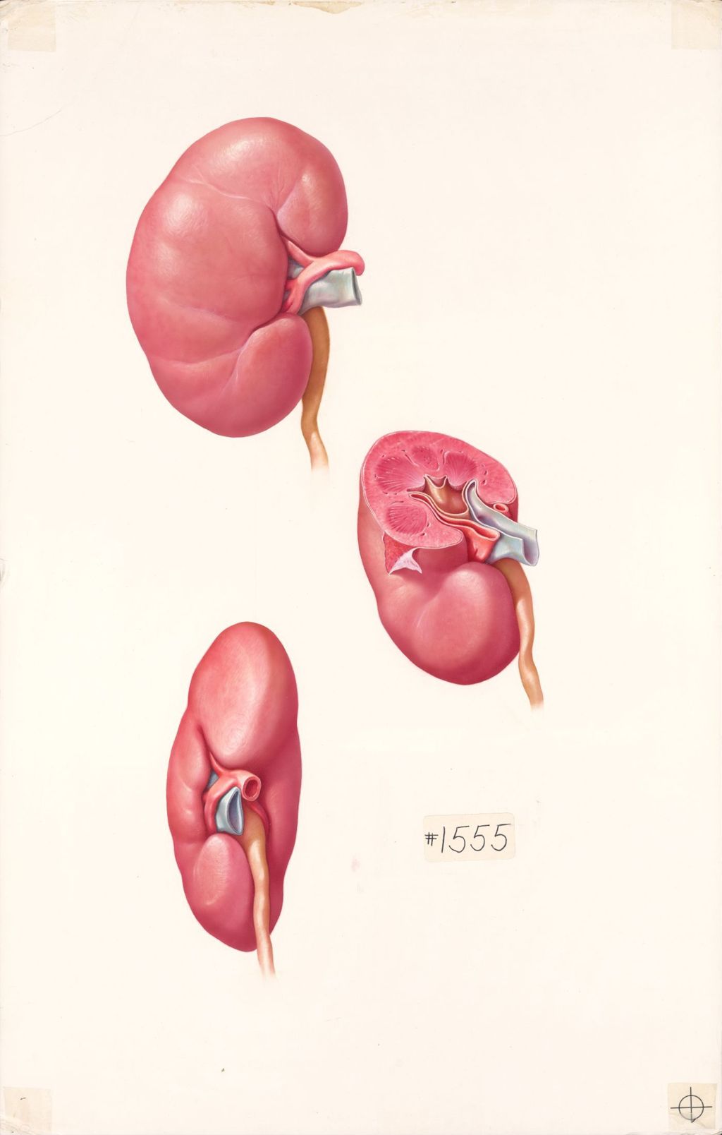 Medical Profiles, The Macroscopic Anatomy of the Kidney, Plate I