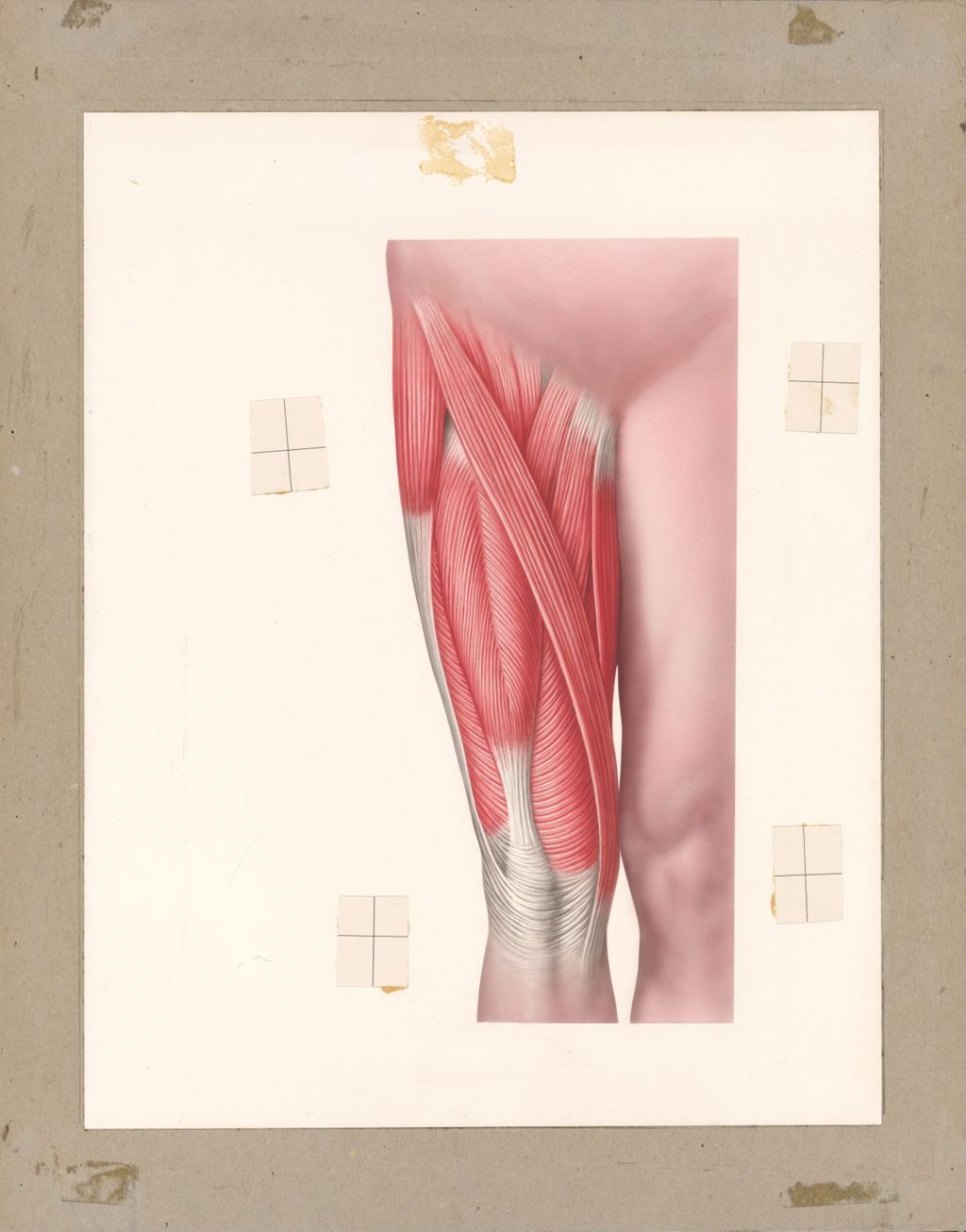 Miniature of Normal Muscles of the arm