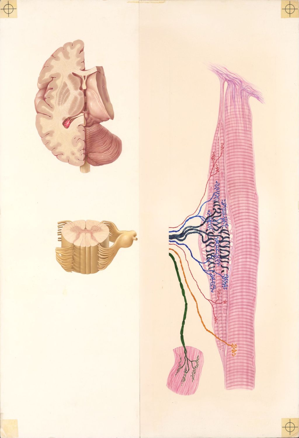 Miniature of Doctor-Patient Explanatory Atlas of Anatomy, Plate II, Circuitry of the Stretch Reflex