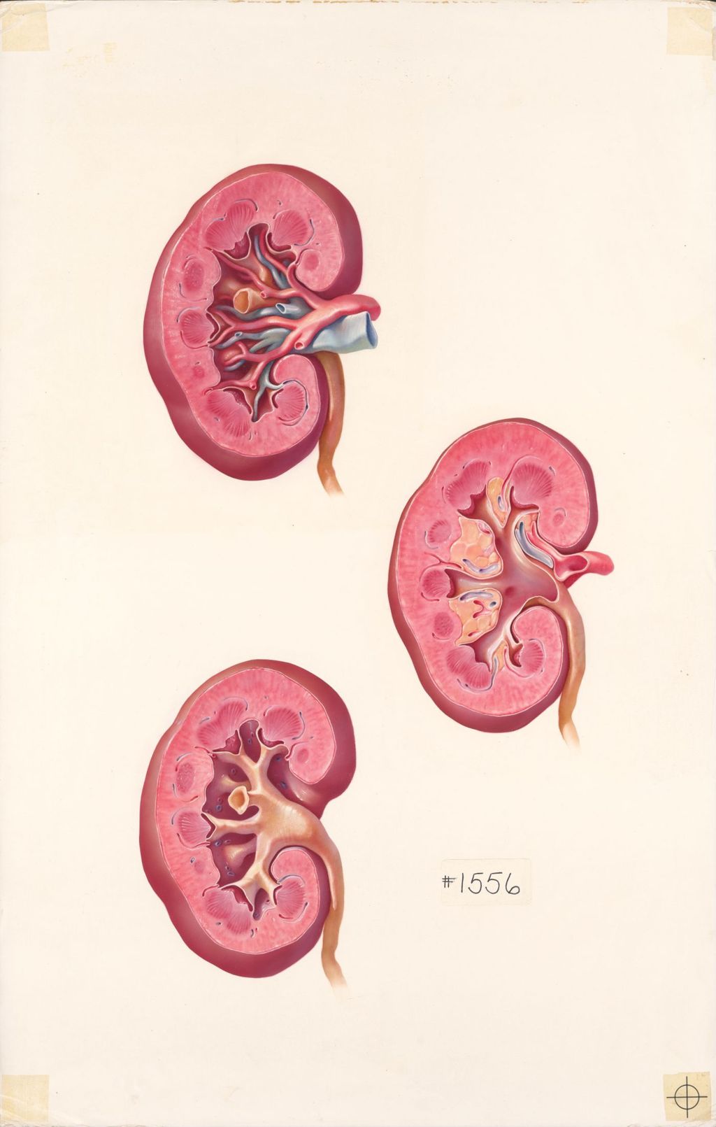Miniature of Medical Profiles, The Macroscopic Anatomy of the Kidney, Plate II