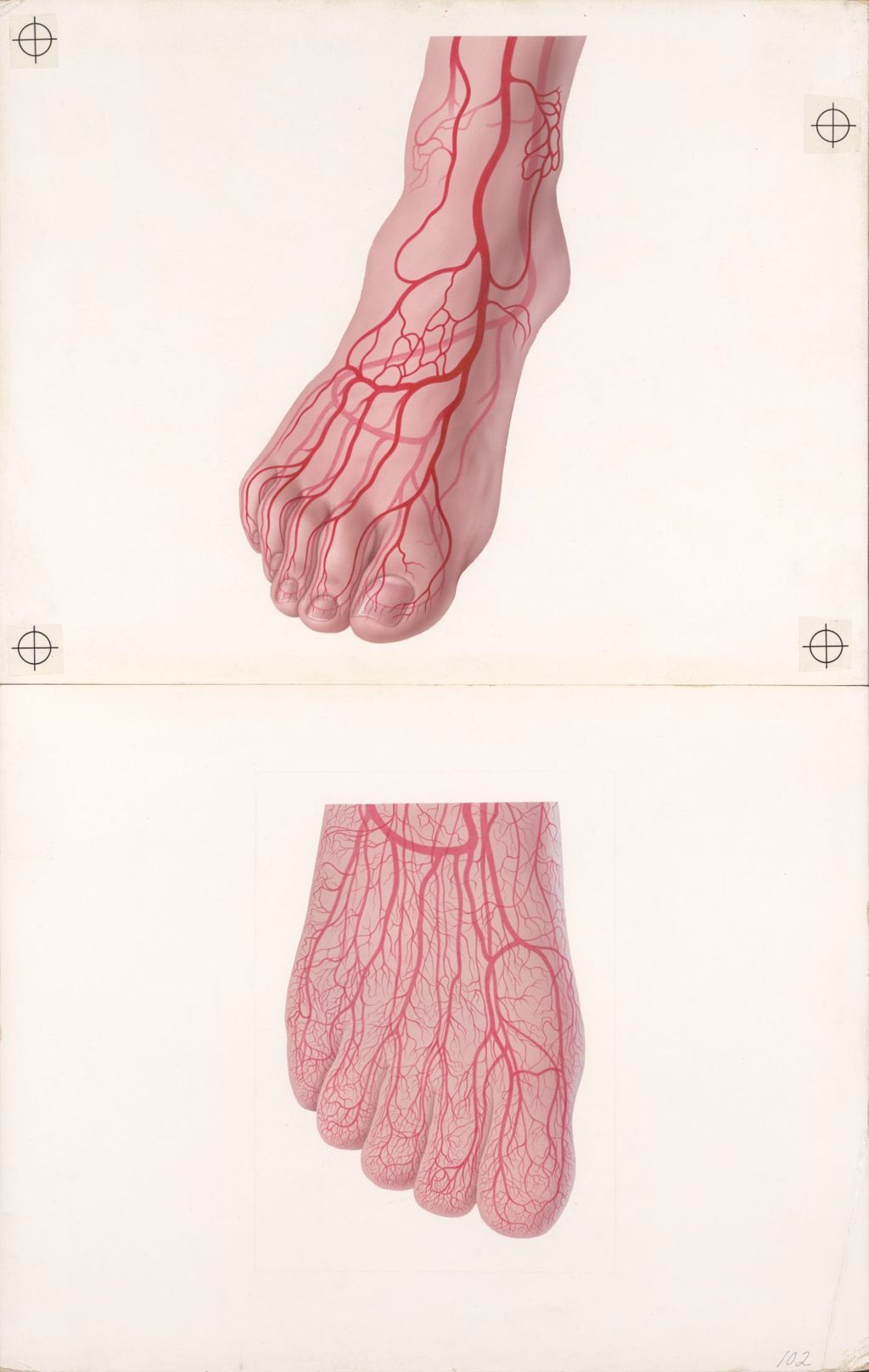 Miniature of Medical Profiles, Aldoril, Increased Resistance to Blood Flow, Plate I