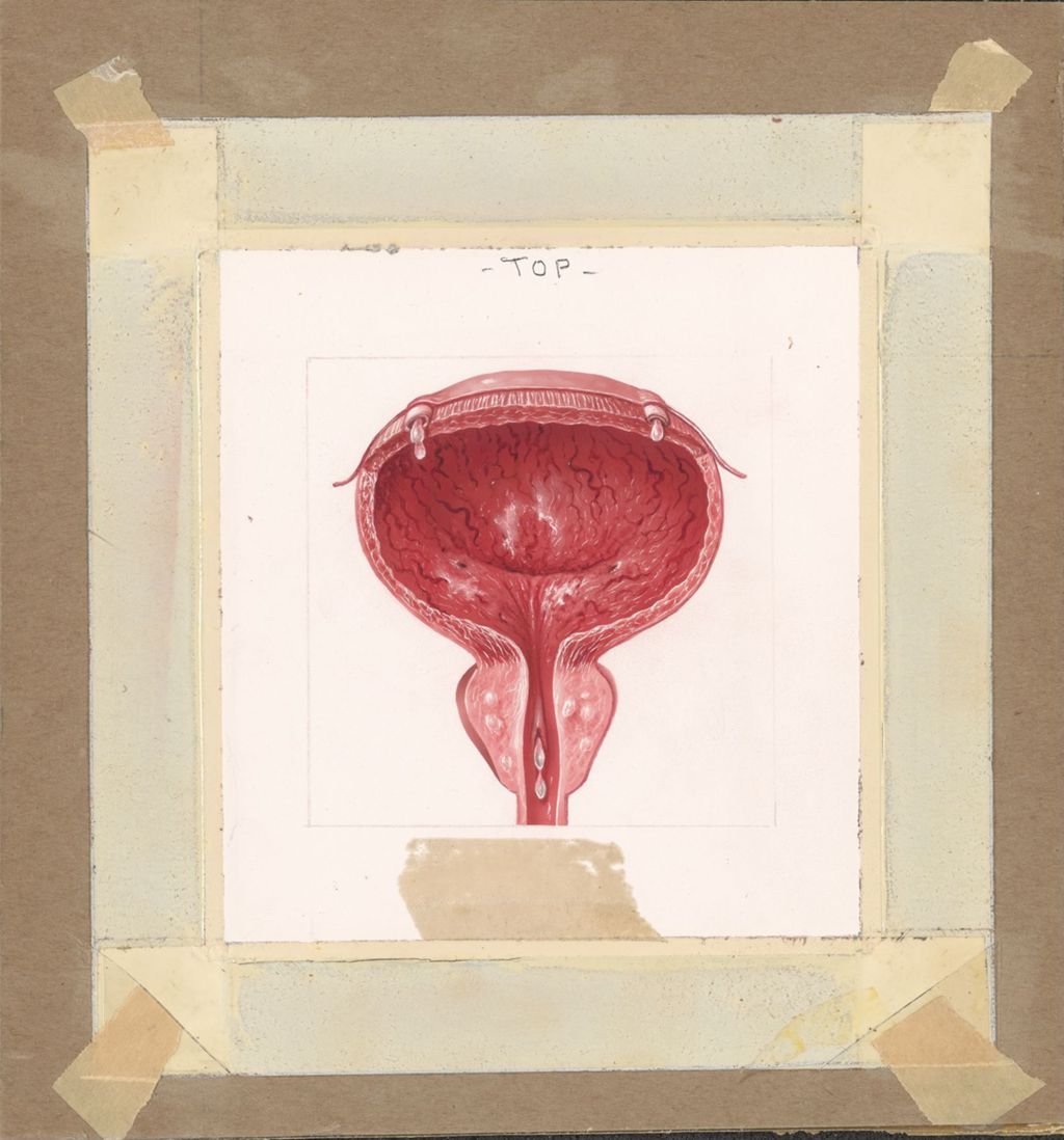 Miniature of Staphyloccic Cystitis and Ureteritis Prostatitis and Urethritis