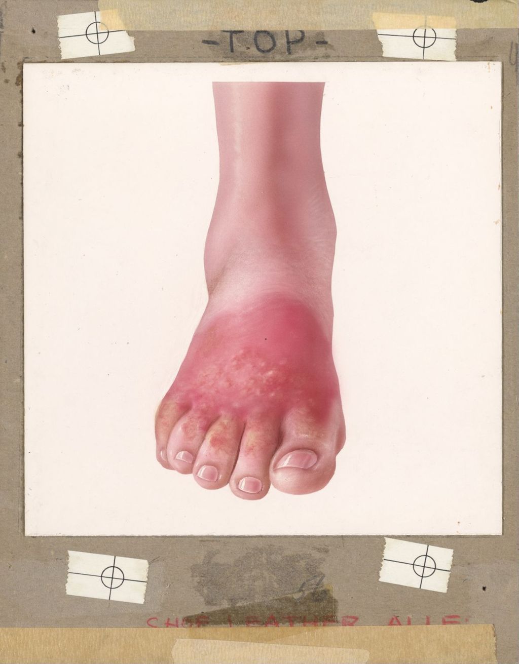 Miniature of Handbook on Common Dermatological Problems, Dermatitis Venenata