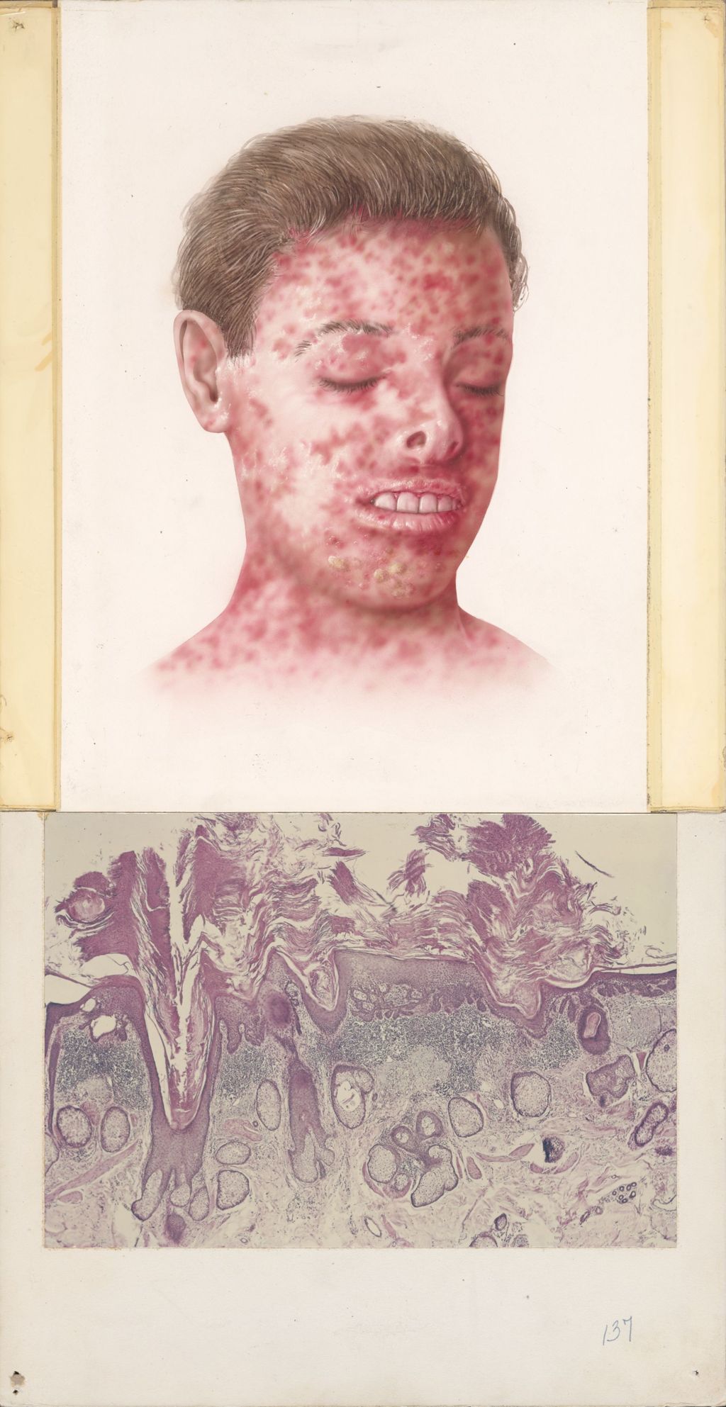 Miniature of Medical Profiles, skin changes due to the action of the ultraviolet light and to sensitivity to the sun's rays