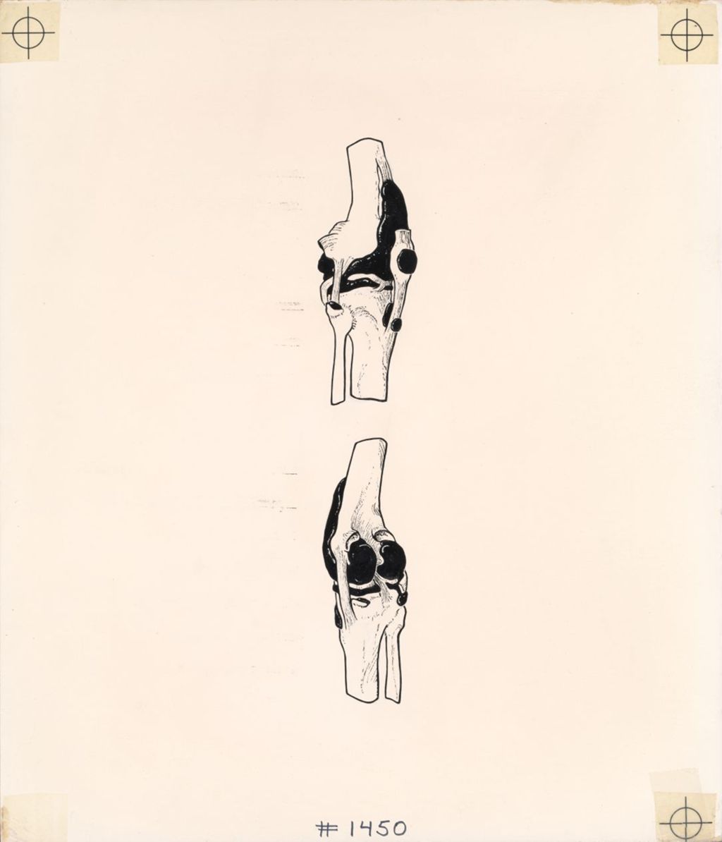 Miniature of The Knee, Mechanical for the Synovial Capsule and Bursae of the Knee