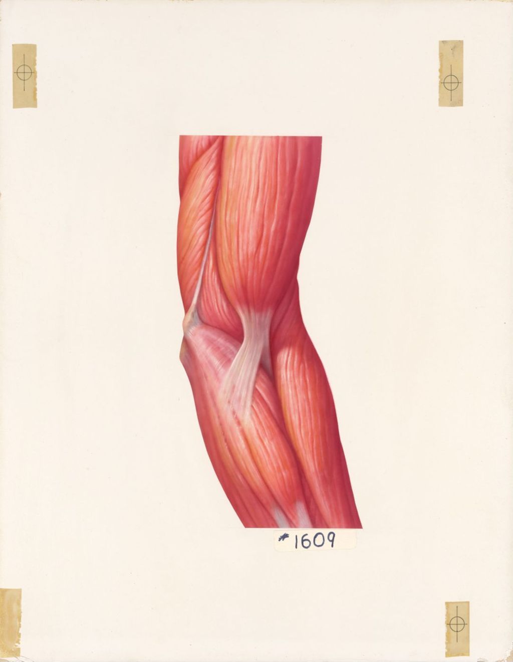 Miniature of The Elbow, The Musculature of the Elbow, Anteromedial Aspect