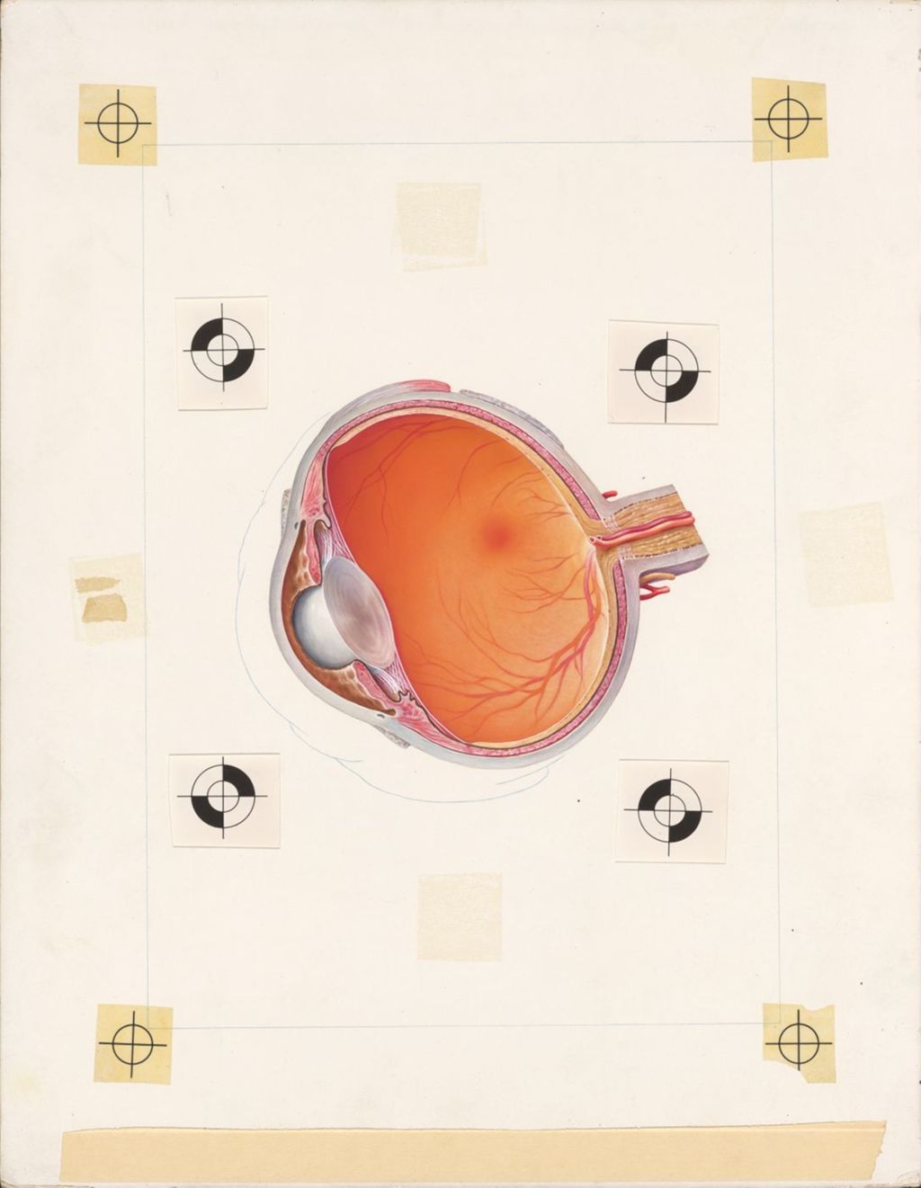 Miniature of The Normal Eye, Progressively Deeper Dissections, D, Obliquely Sectioned Eye Showing the Relationship of Its Coats